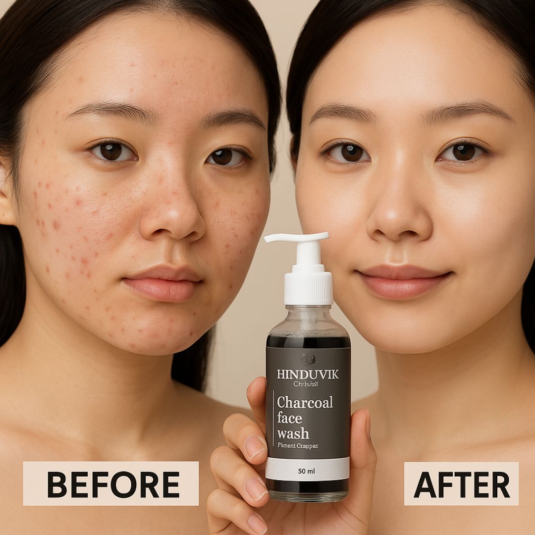 Luxury Charcoal Face Wash – Anti-Acne & Glow Cleanser with Aloe Vera & Essential Oils – 50ml