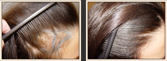 HINDUVIK Hair Care Combo: Anti-Hair Fall Herbal Shampoo & Lotus Nourishing Conditioner